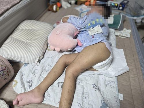 슬라이드 이미지